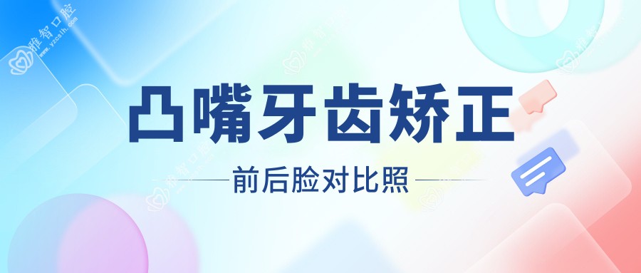 凸嘴牙齿矫正前后脸对比照