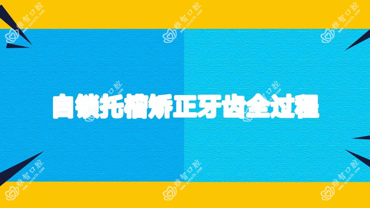 自锁托槽矫正牙齿全过程
