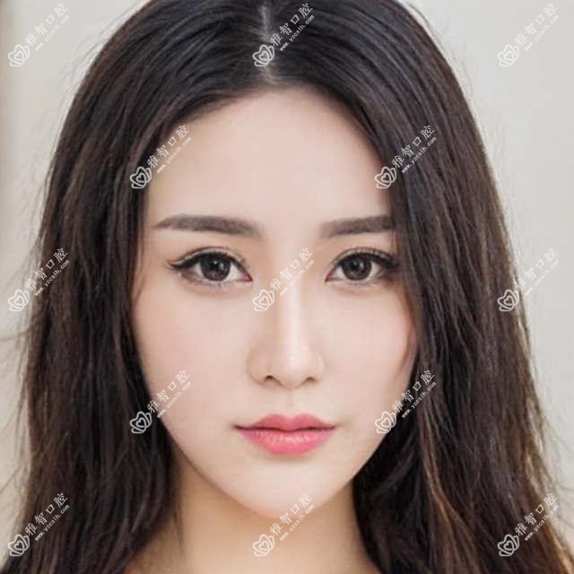 沈阳2025国产种植牙价格表发布!(含江阴金泰克种植牙/北京莱顿BLB种植体价格价格表)