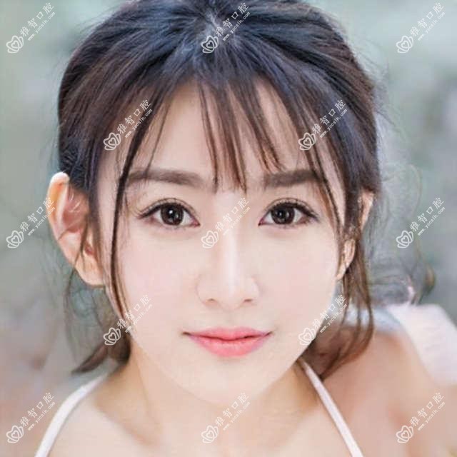 烟台2025光固化复合树脂补牙价目单揭秘！（含瓷贴面/美容冠价格价格表）