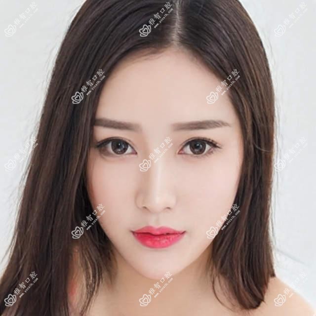 乌鲁木齐牙齿缺损修复价格表2025(顾坚韧口腔1290元起/乌鲁木齐黄锟口腔1358起)