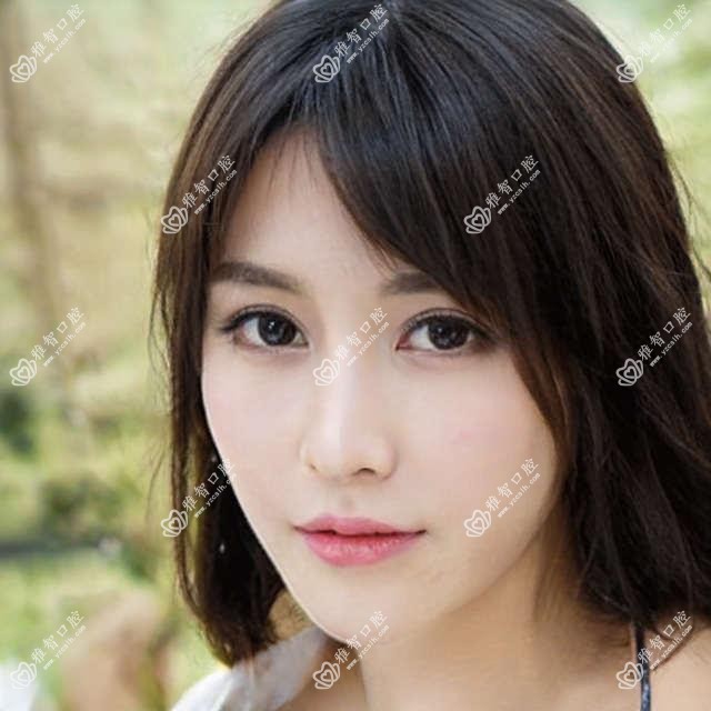 吉林美容冠排行榜前10医院名单+费用收费表介绍!技术好技术靠谱