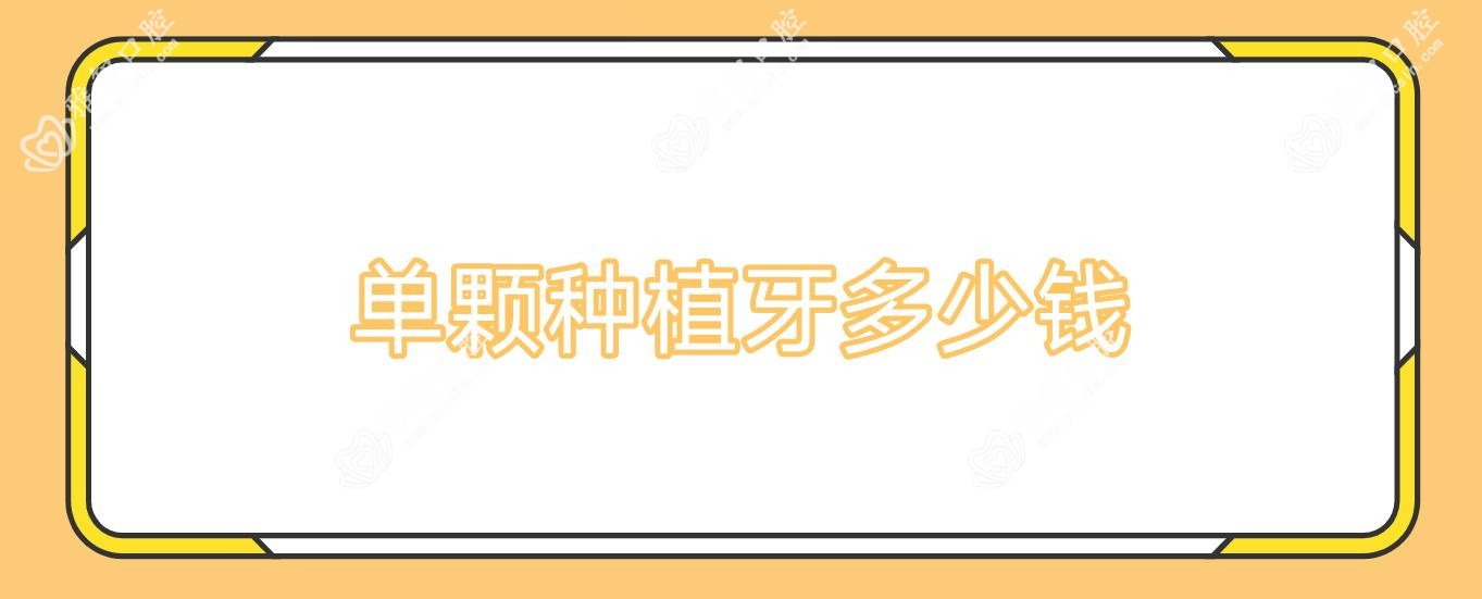 单颗种植牙多少钱