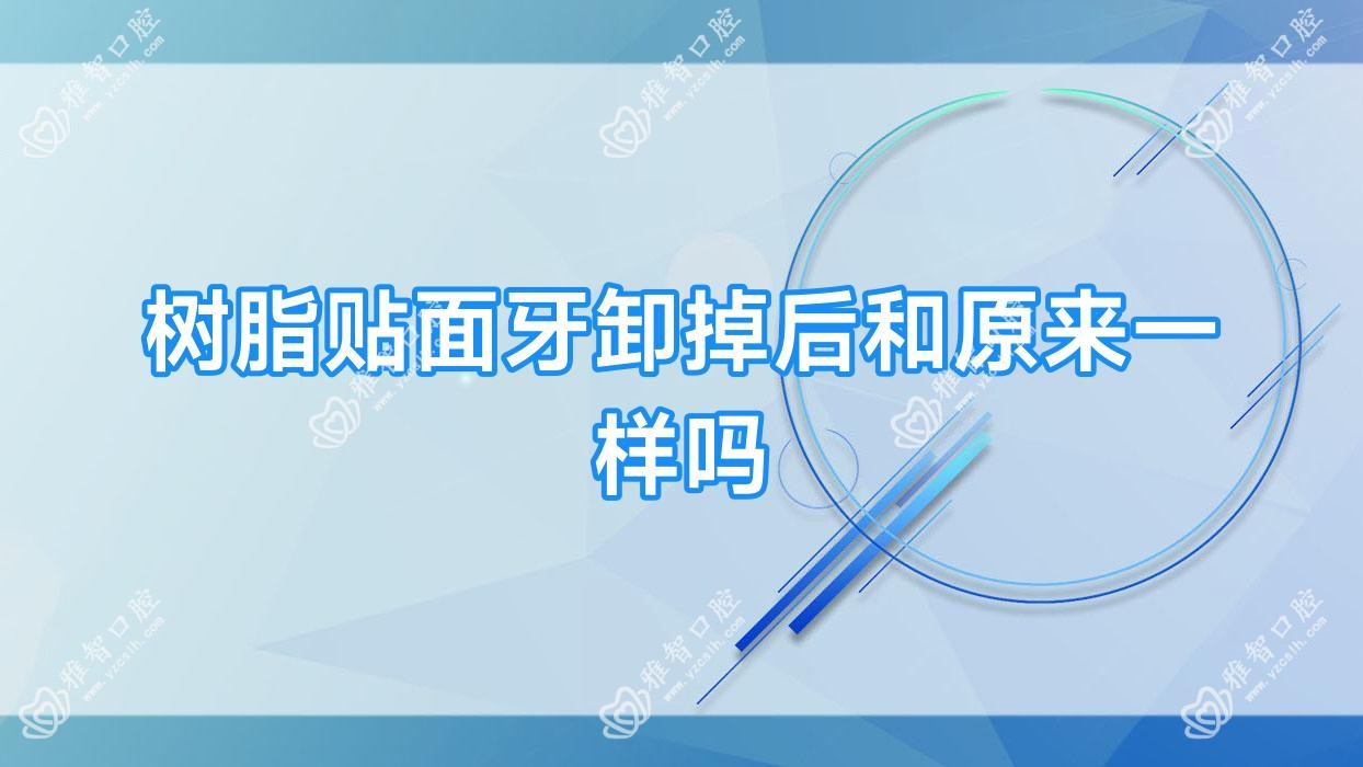 树脂贴面牙卸掉后和原来一样吗