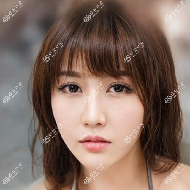 中山时代天使隐形矫正器价格表2025年崭新发布,含隐适美隐形矫正器/正雅隐形矫正器/时代天使隐形矫正器费用明细