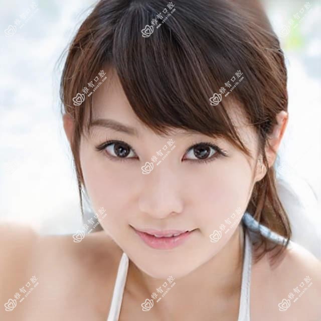 淮安韩国登特斯种植牙收费表2025年新版更新,含瑞士ITI种植牙/瑞典诺贝尔种植牙/韩国登腾种植牙费用明细