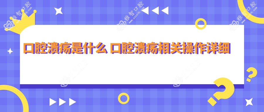 口腔溃疡是什么 口腔溃疡相关操作详细介绍