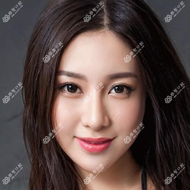 乌鲁木齐德国费亚丹种植牙大概是多少钱?11959元可做,术前指南教你不被坑