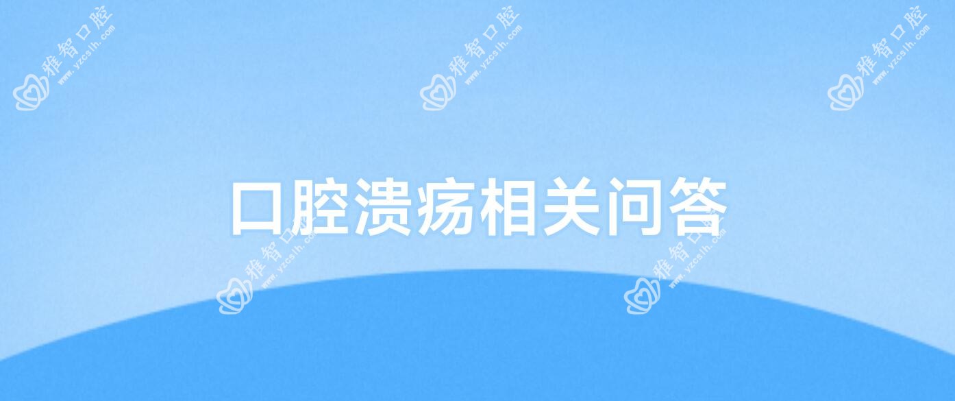 口腔溃疡相关问答