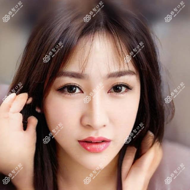 鄂尔多斯牙齿漂白医院价目单(含鄂尔多斯赵君口腔/达拉特旗皓齿口腔/鄂尔多斯奥麒口腔医院牙齿漂白收费)