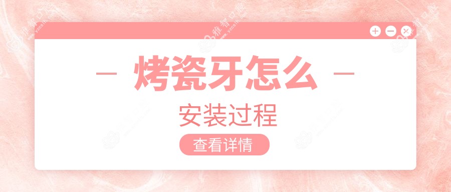 烤瓷牙怎么安装过程