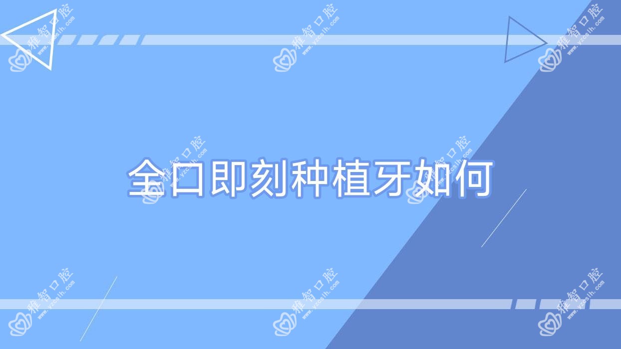 全口即刻种植牙如何