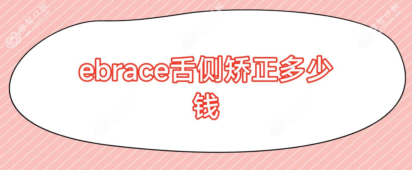ebrace舌侧矫正多少钱