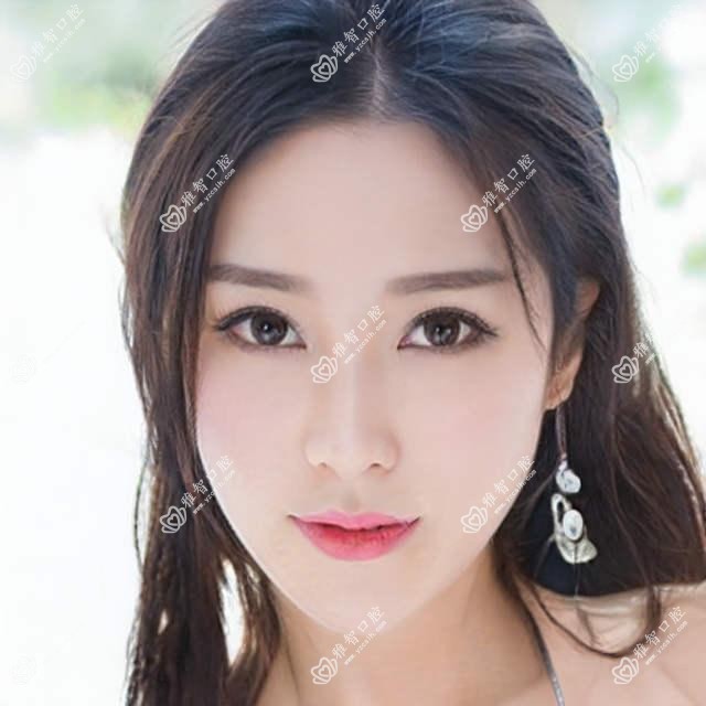 廊坊2025allon6全口种植牙价目表揭晓!(含allon4全口种植牙/全口种植牙收费价目表)