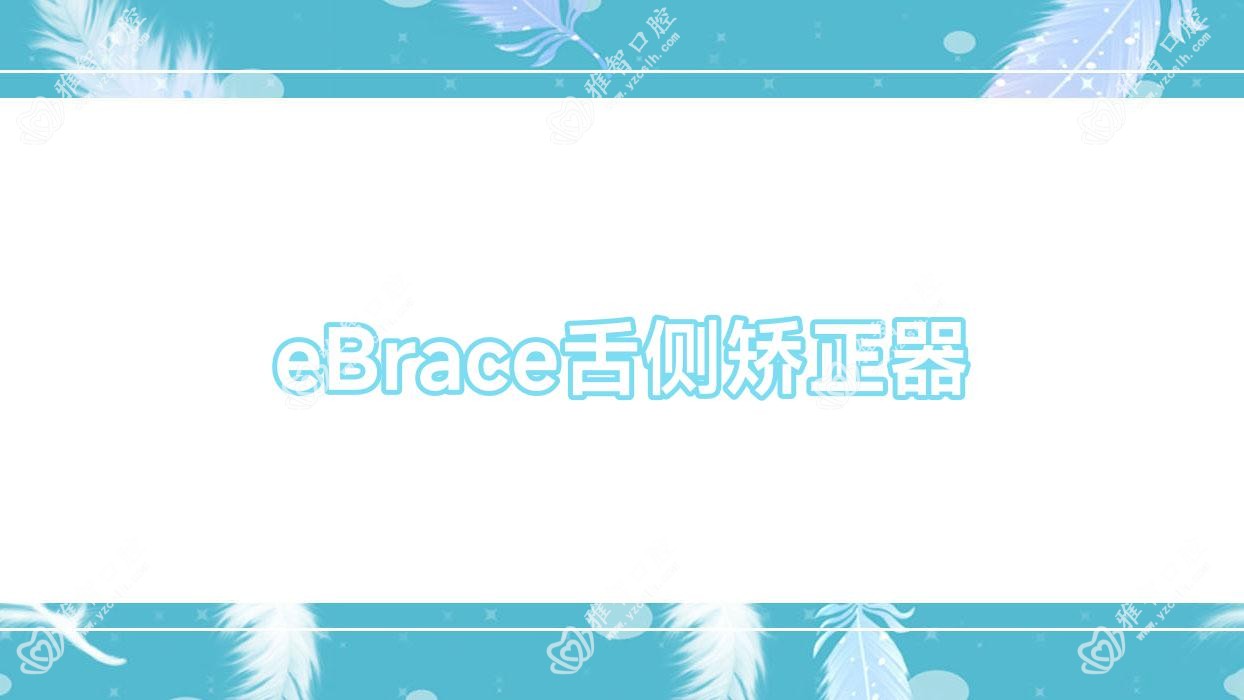 eBrace舌侧矫正器