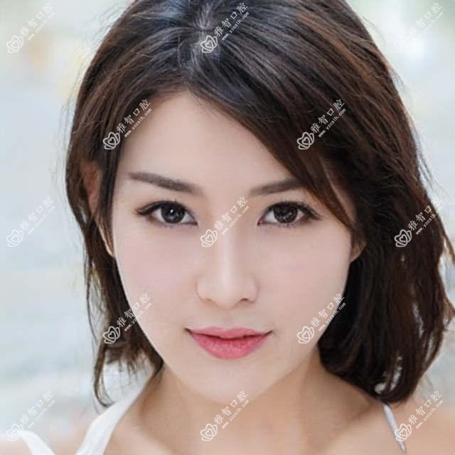 三亚透明隐形矫正2025收费表:虎牙矫正1.5w+半隐型矫正1w+深覆颌1w+正畸5k+