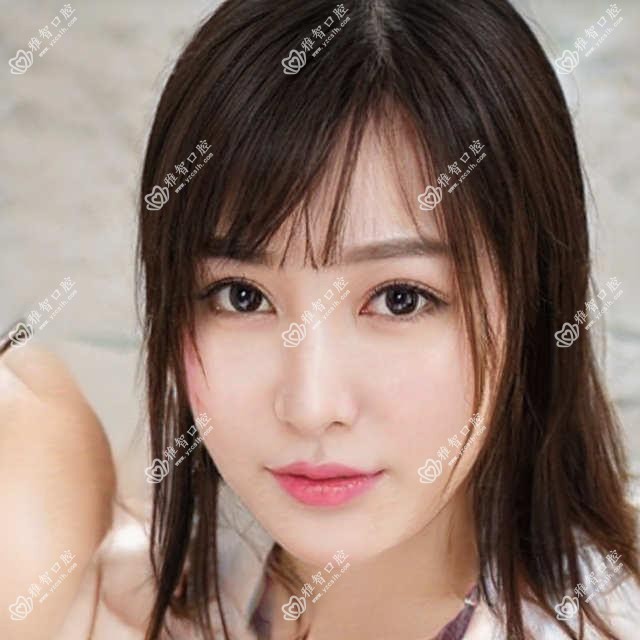 潍坊牙齿抛光多少钱?2025价格表公开了~潍坊牙齿抛光标准收费马上看!