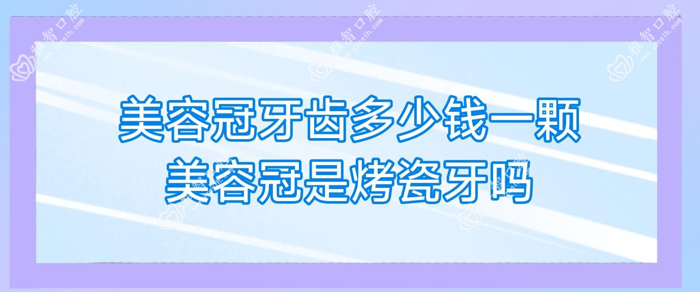 美容冠牙齿多少钱一颗 美容冠是烤瓷牙吗