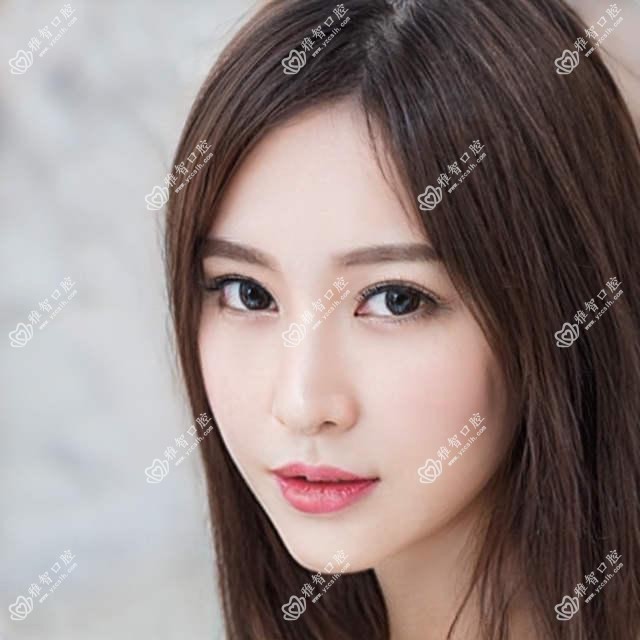 奥齿泰考虑因素有哪些?奥齿泰相关操作详细介绍?