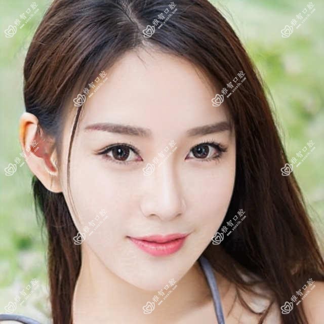 重庆贵金属烤瓷牙排行及收费分享!价格也不贵的医院是那家呢?