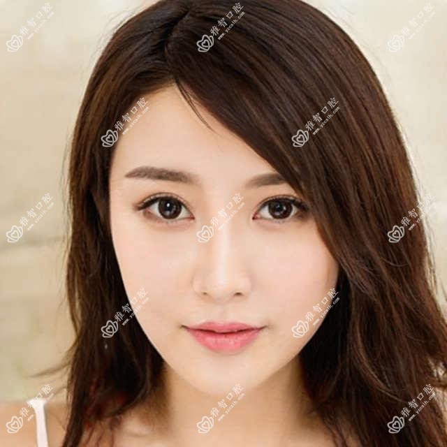 烟台韩国美格真种植牙排名榜单及收费介绍!好还便宜的医院是那家呢?