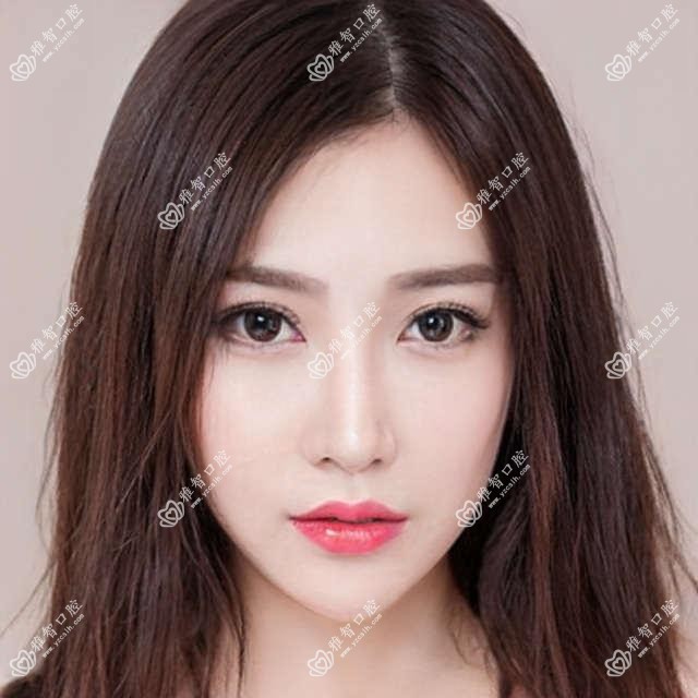 佛山茶渍牙美白收费表,地址在佛山顺德区/三水区/高明区茶渍牙美白收费在360-2268元