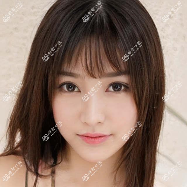 2025嘉兴儿童隐形牙套矫正价格表:儿童隐形牙套矫正/儿童硅胶牙套矫正器/儿童功能性矫正器等儿童隐形牙套矫正价格预览
