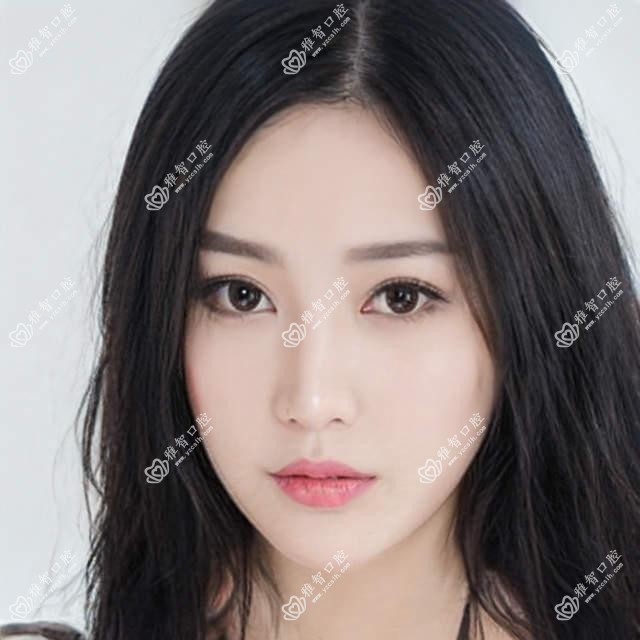 宜昌3M树脂补牙是多少?磨牙1.2千元左右