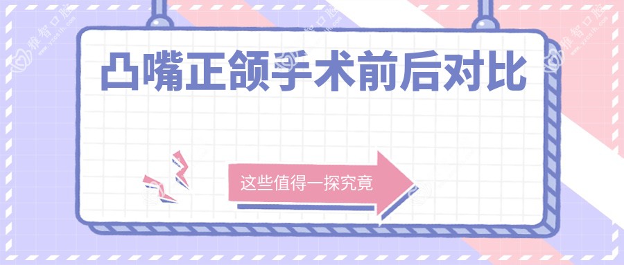凸嘴正颌手术前后对比