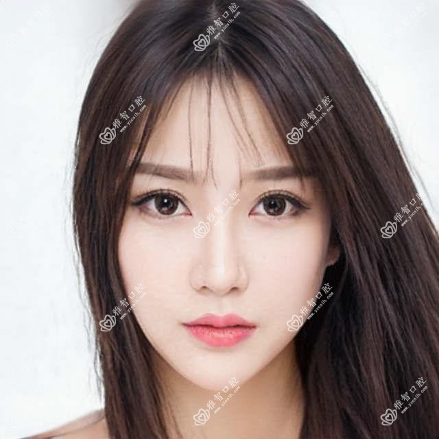 临沂中龋排行榜及费用分享!好还便宜的医院是那家呢?