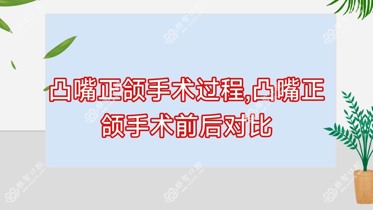 凸嘴正颌手术过程,凸嘴正颌手术前后对比
