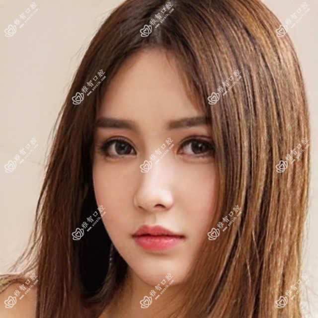 2025年宜春美国百康种植牙价格表:美国百康种植牙10498+韩国登腾种植牙6千+德国ICX种植牙8千+韩国dio种植牙5千+