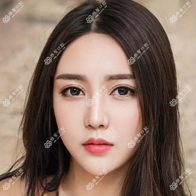 丽水凸嘴正颌手术收费价格表2025（丽水凸嘴正颌手术价格概览表）