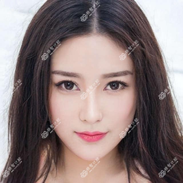 哈尔滨种植牙技术价格表2025年崭新公布,含即刻种植牙/普通种植牙/微创种植牙费用明细