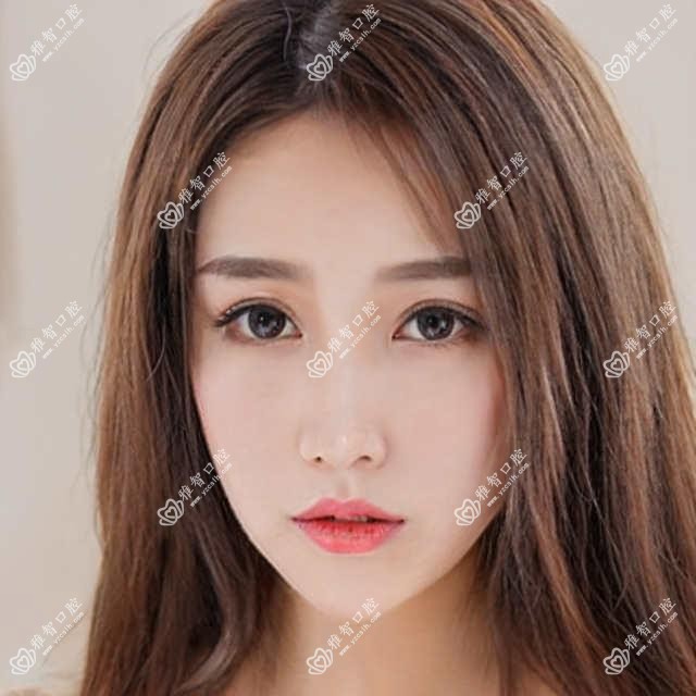 郑州2025牙齿漂白价格表揭晓!(含喷砂洗牙/烟渍牙美白收费收费表)