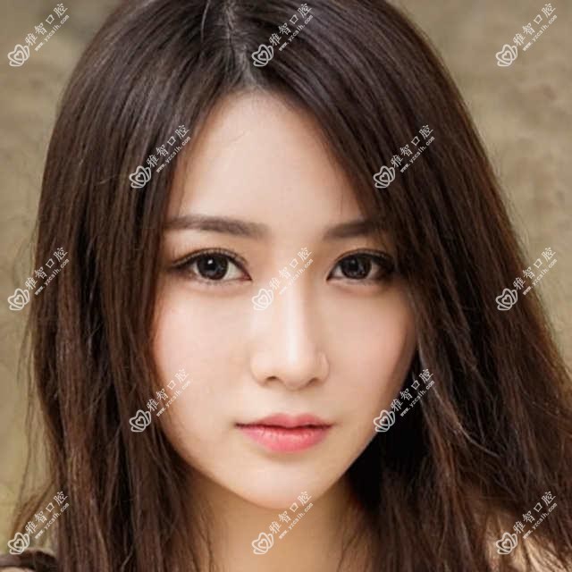 时代天使分析?时代天使治疗价格贵吗?