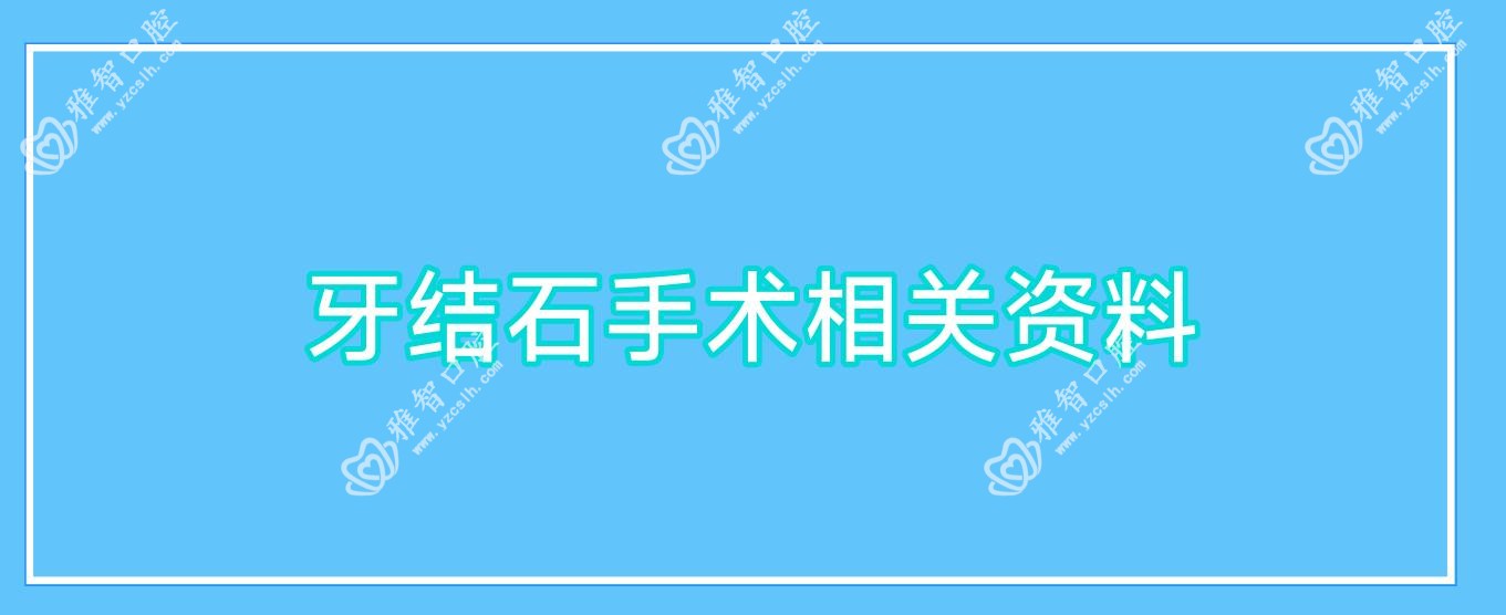 牙结石手术相关资料