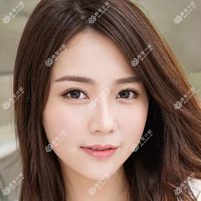 阜阳常规种植牙收费2025年新详尽揭秘-颍州佑康口腔/阜阳爱齿口腔(东关店)常规种植牙价目表(价格)