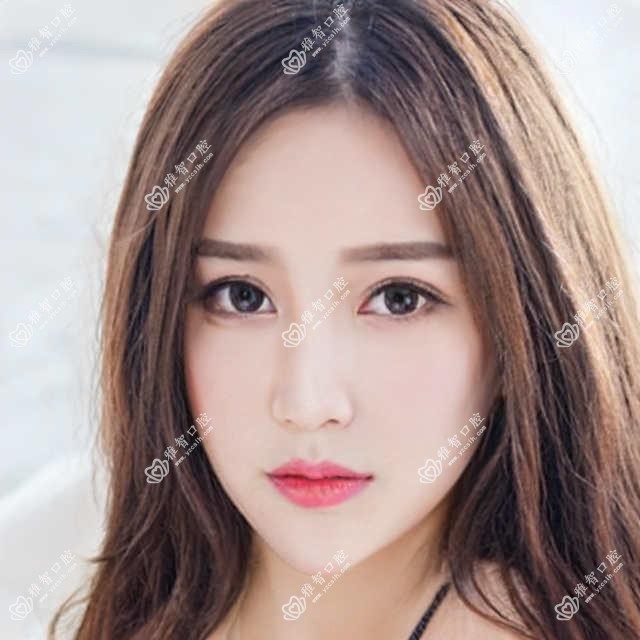 根管治疗是什么 根管治疗相关操作详细介绍