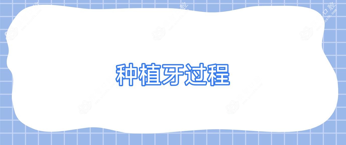 种植牙过程