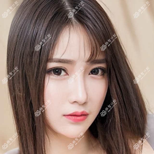南宁超声波洗牙收费表(费用)-南宁超声波洗牙偏低贵不贵