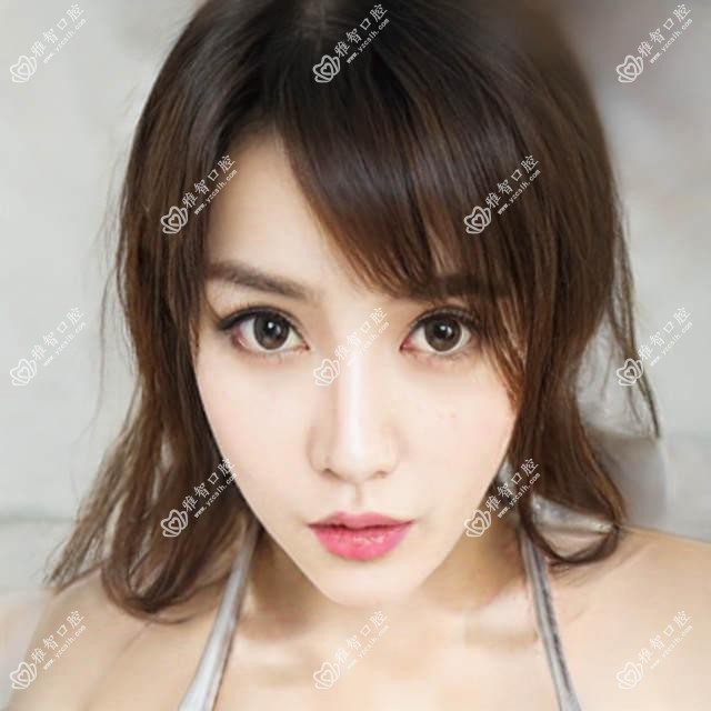 乳牙拔牙医生科普 乳牙拔牙手术注意事项