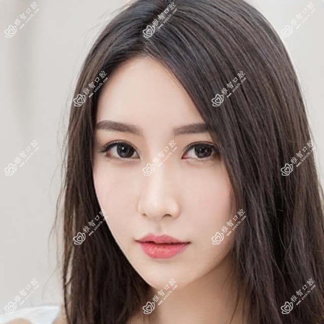 儿童补牙的项目百科 儿童补牙治疗价格贵吗