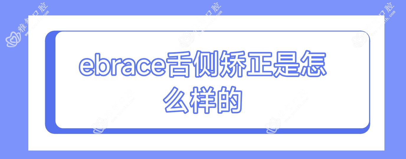 ebrace舌侧矫正是怎么样的