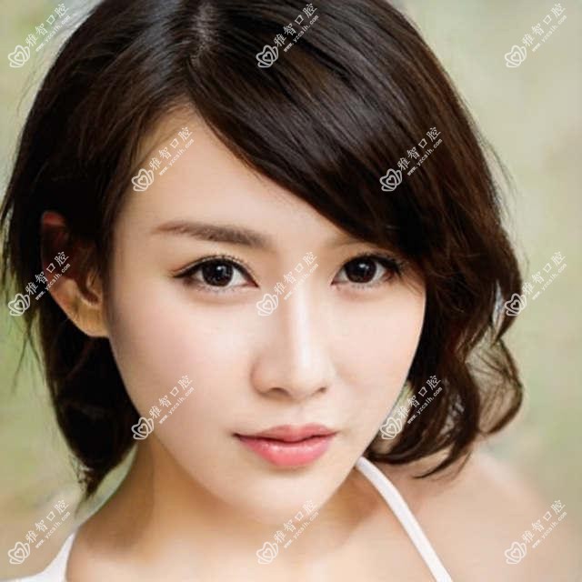 太原咖啡牙美白是多少?美国皓齿美白2.2k元左右