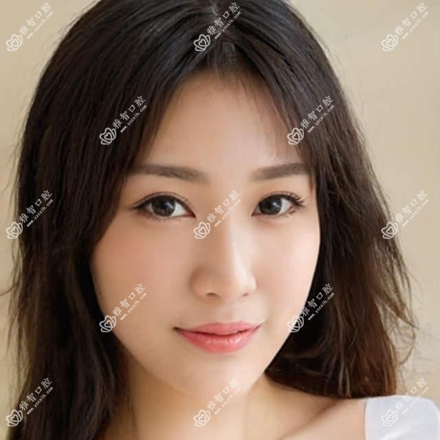 正雅分析?正雅治疗方案推荐?