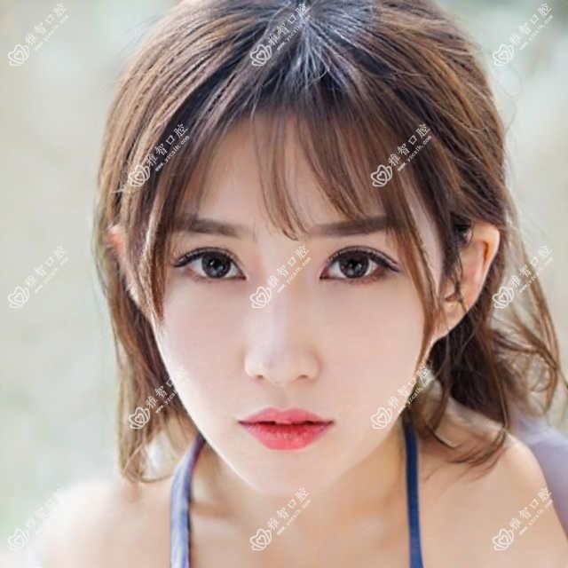 江门儿童功能性矫正器多少钱?2690元可做,术前指南教你不被坑