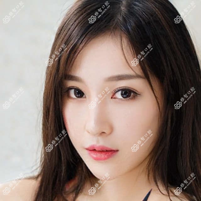 鄂尔多斯价目单2025:ITI瑞锆种植牙价格23398元,法国安多健种植牙1.2w元起