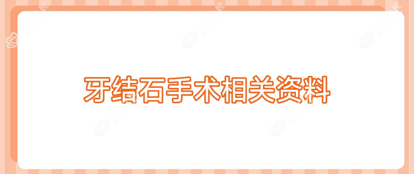 牙结石手术相关资料