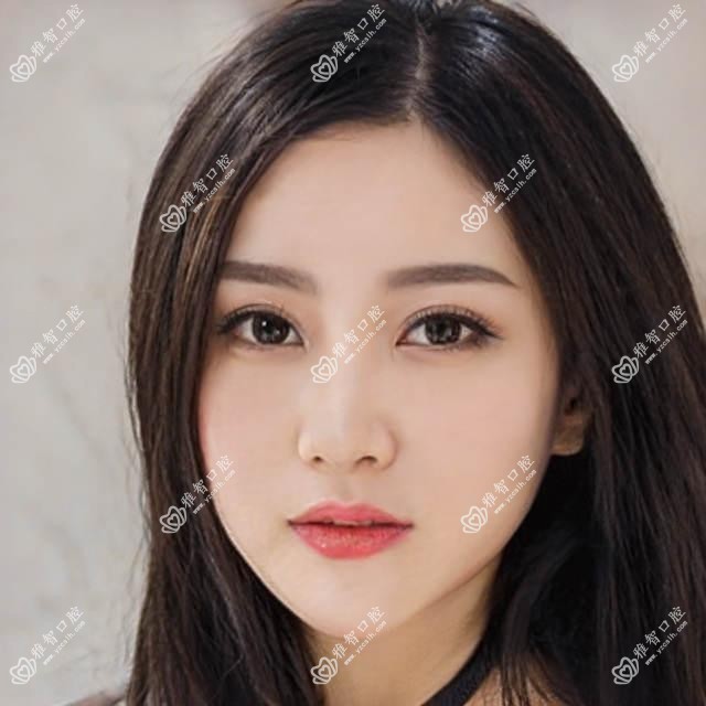 武汉单颗牙种植收费表-武汉哪些医院单颗牙种植成效好且费用合理